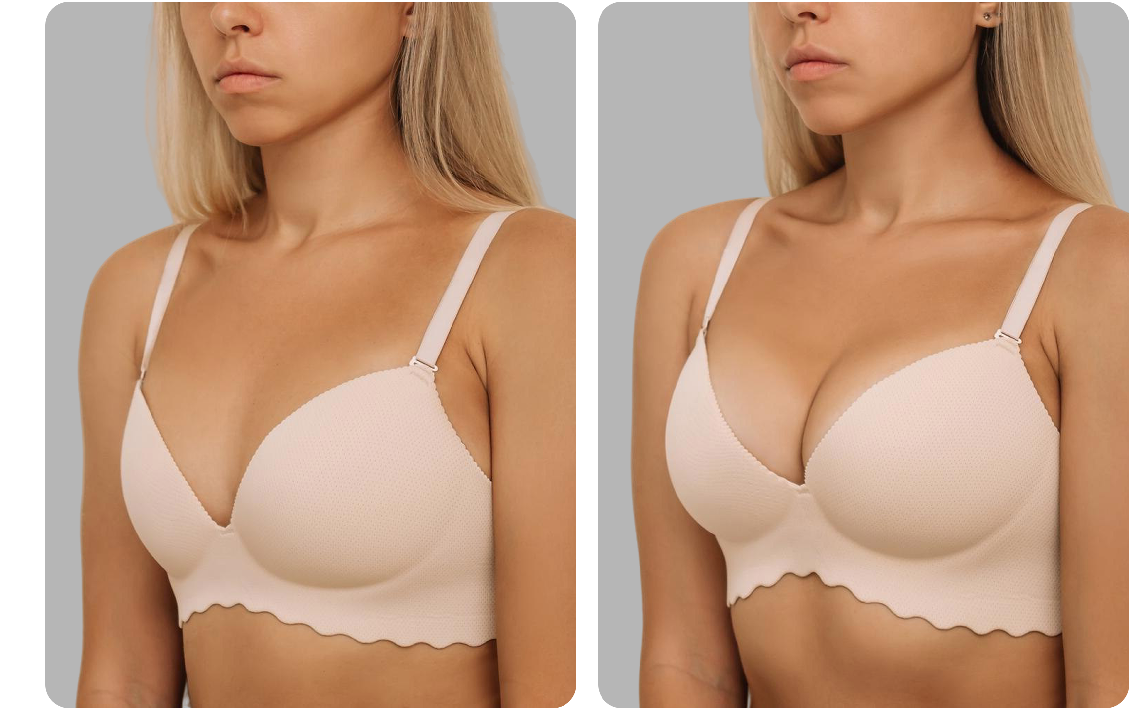 Breast Lift before result