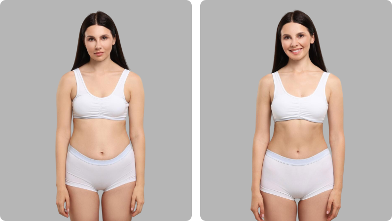 Liposculpture before result