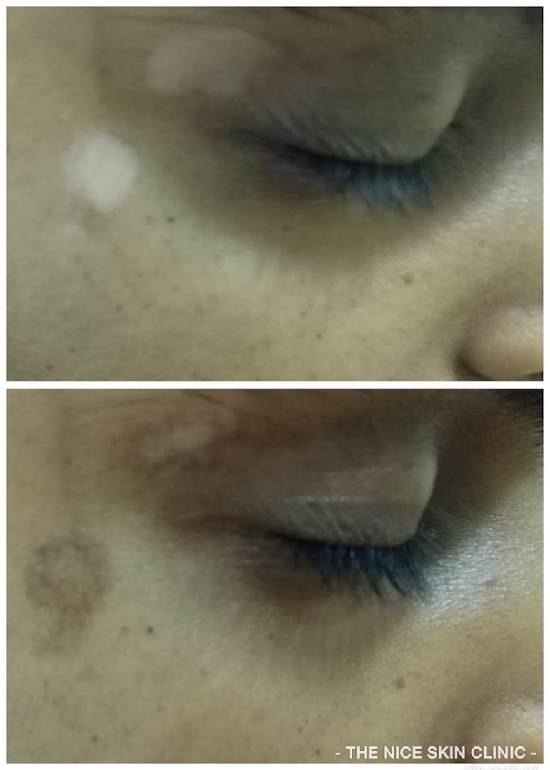 The Cosmetic Skin Clinic - Anti Wrinkle - Image 2