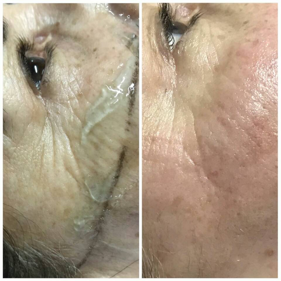 The Cosmetic Skin Clinic - Anti Wrinkle - Image 3