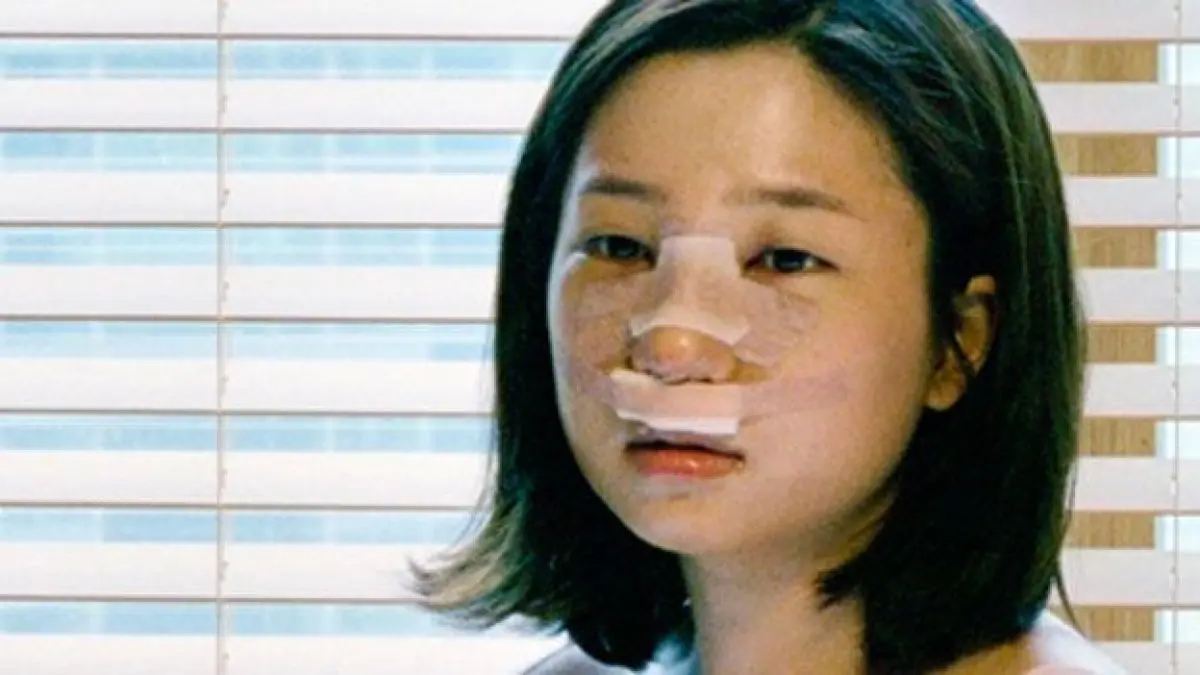 Cosmetic Surgery Thailand - Image 3