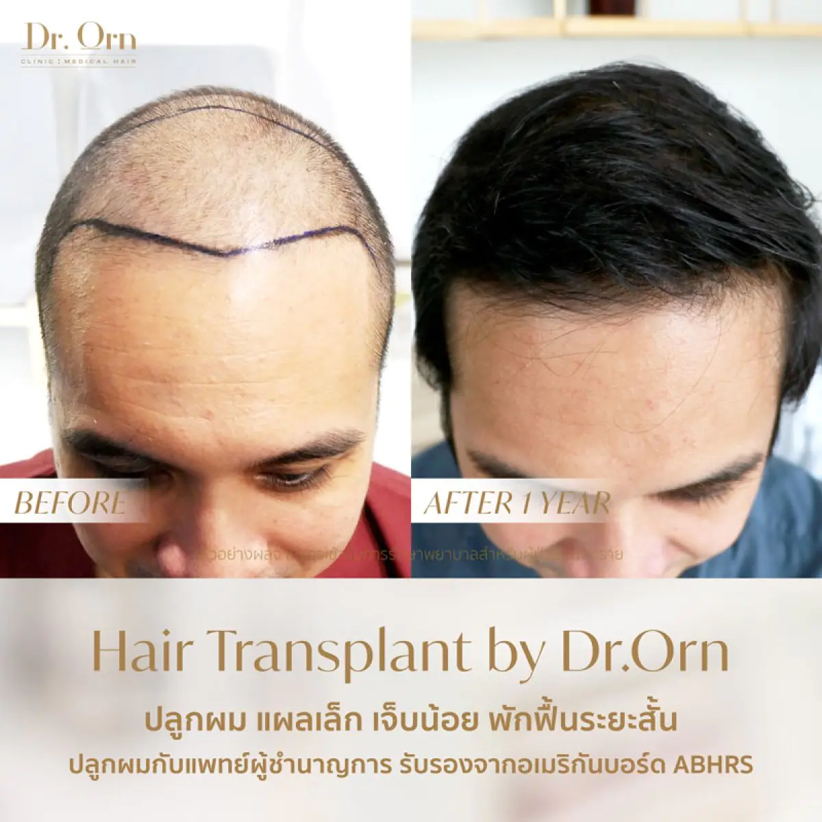 Dr.Orn Clinic : Medical Hair - Image 2