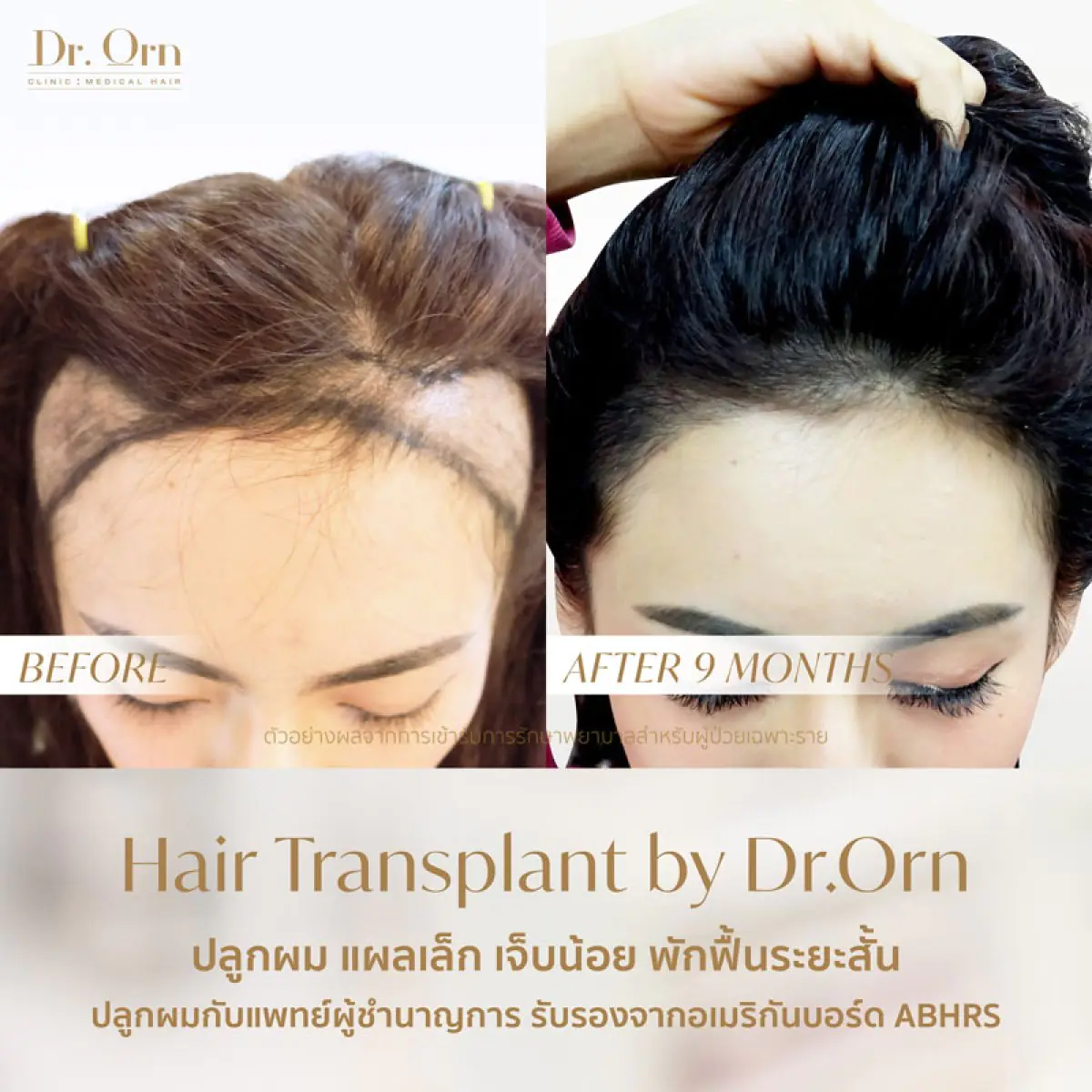 Dr.Orn Clinic : Medical Hair - Image 3