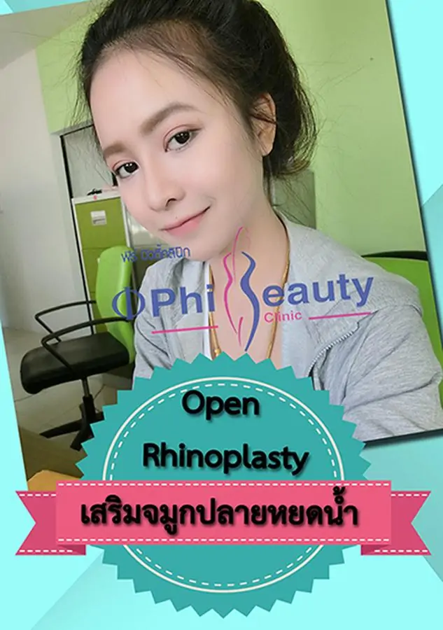 Phi Beauty Clinic - Image 3