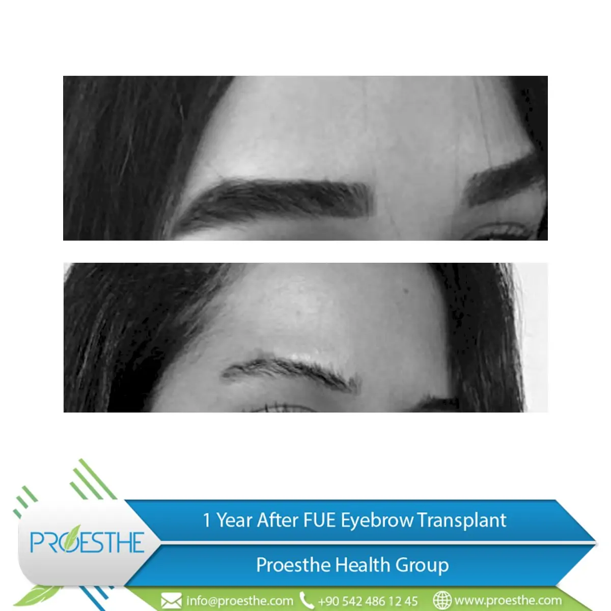 Proesthe Hair Transplant Center - Image 2