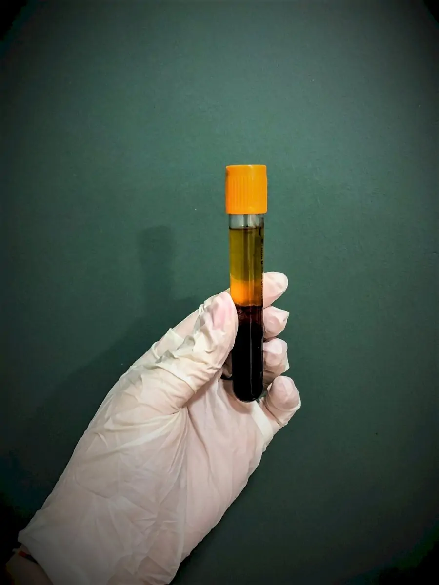 Emphair Hair Transplant Clinic - Image 3