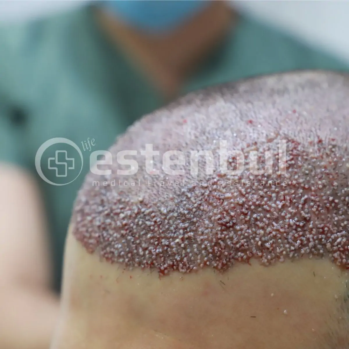 Estenbul Health - Image 2