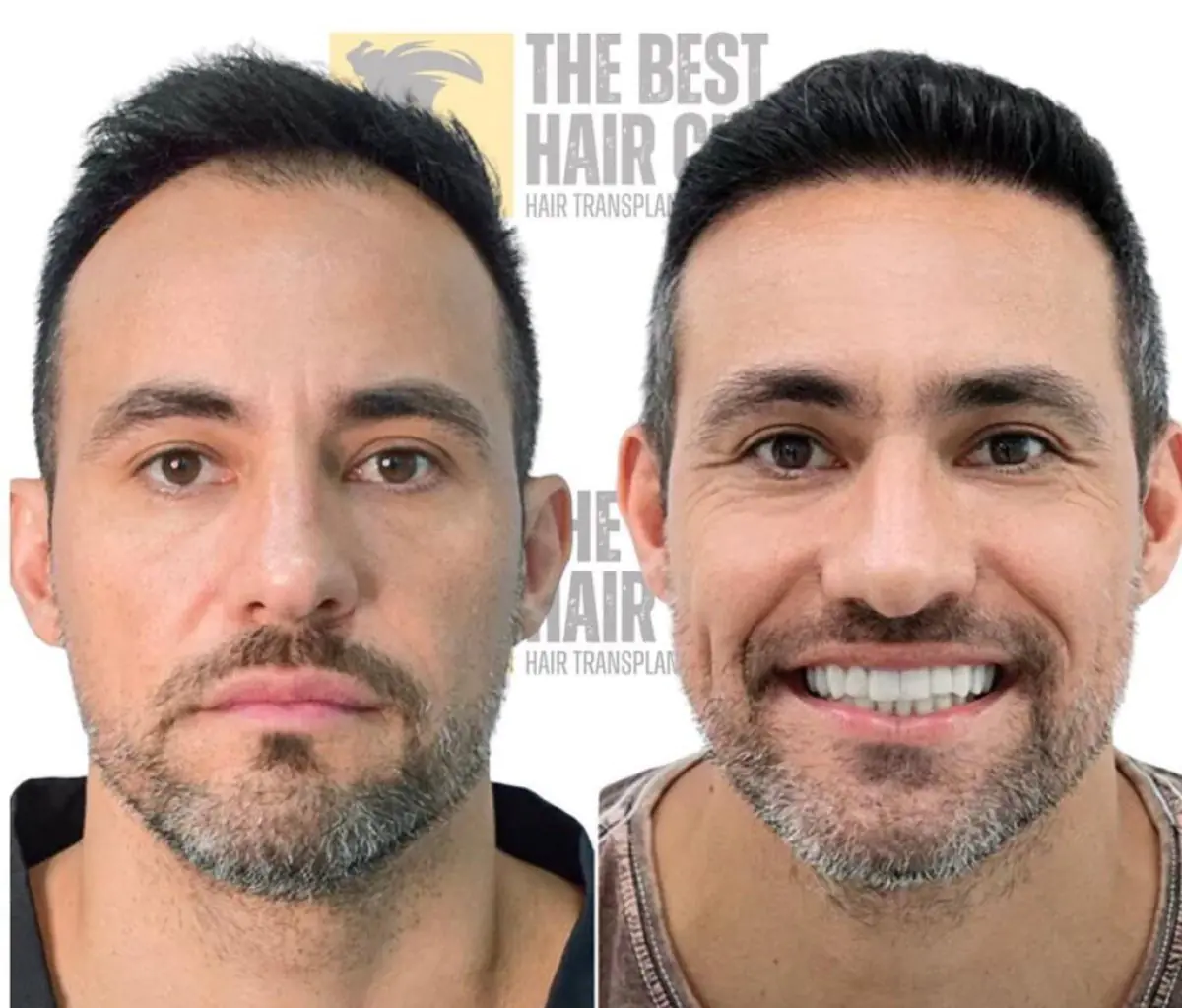 The Best Hair Clinic - Image 2