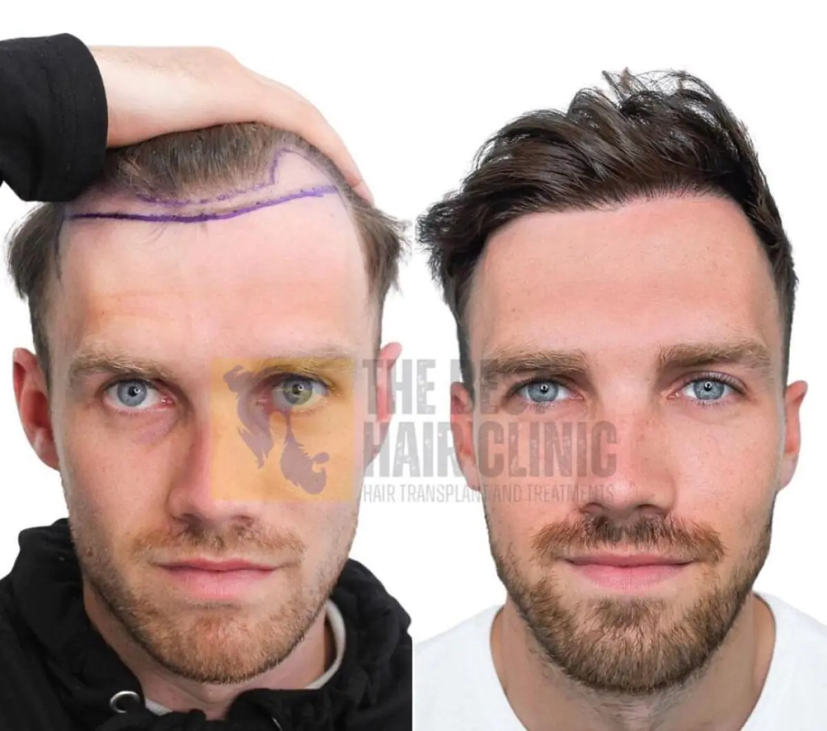 The Best Hair Clinic - Image 1