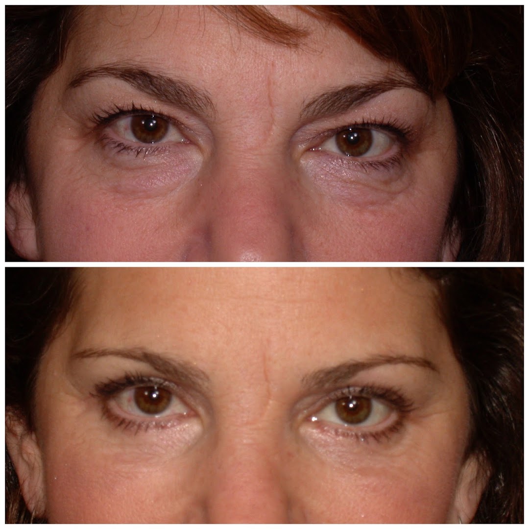 Dr. Francine L. Vagotis - Plastic Surgeon - Image 3