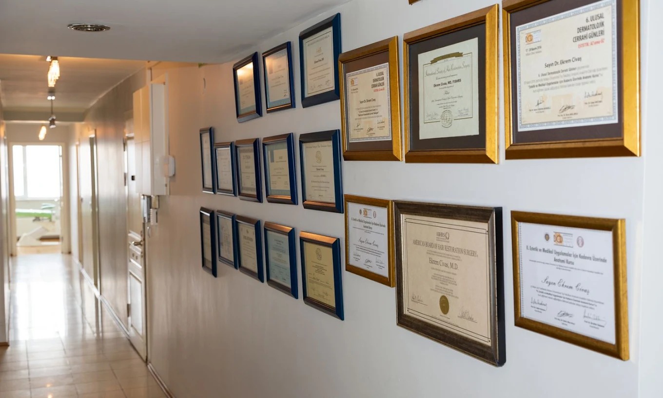 Civas Hair Transplant - Image 2