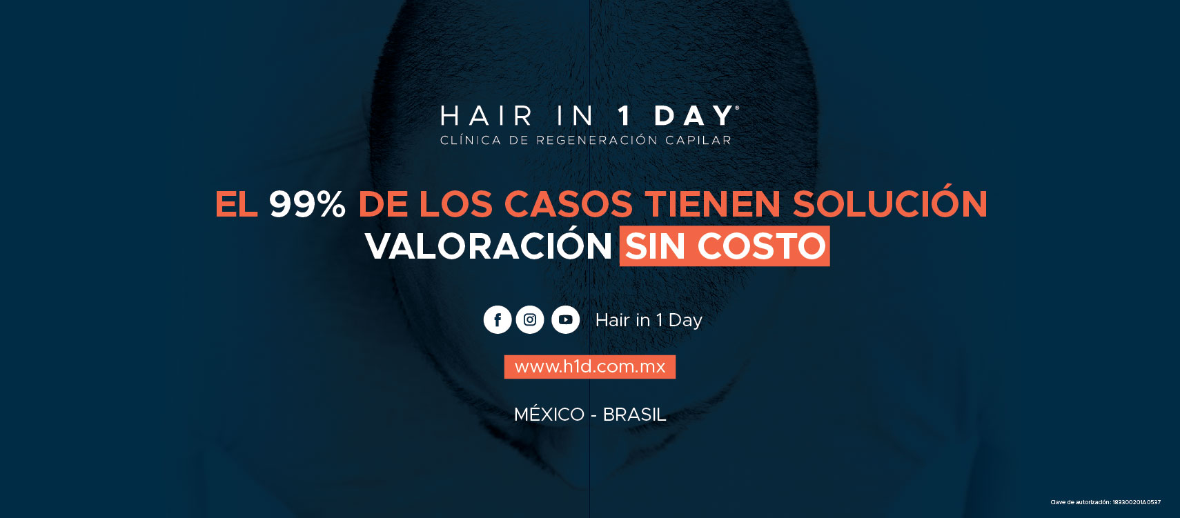 Hair In 1 Day Mexico City - Image 3