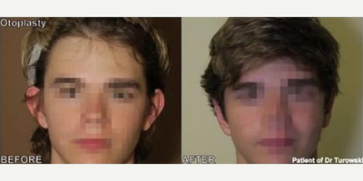 Case 11063 - Man treated with Ear Surgery