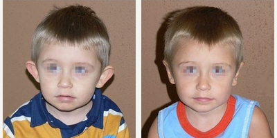 Case 11069 - Man treated with Ear Surgery