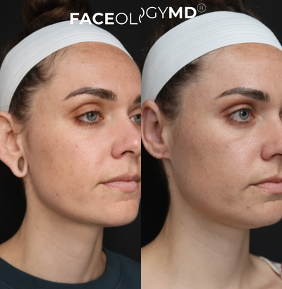 Case 11085 - Woman treated with Ear Surgery