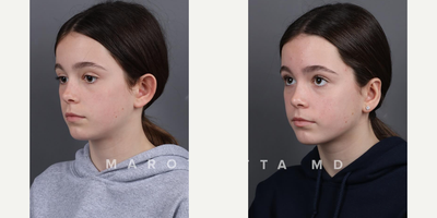 Case 11096 - Woman treated with Ear Surgery