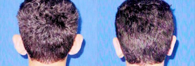 Case 11110 - Man treated with Ear Surgery