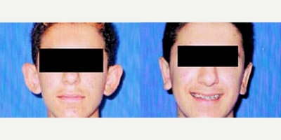 Case 11114 - Man treated with Ear Surgery