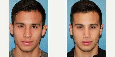 Case 11115 - Man treated with Ear Surgery