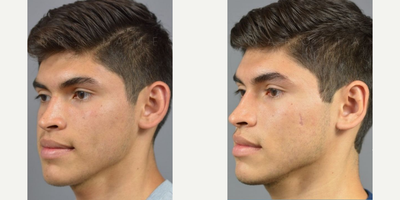 Case 11117 - Woman treated with Ear Surgery