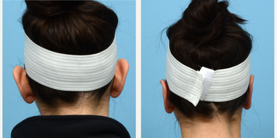 Case 11146 - 25-34 year old woman treated with Ear Surgery