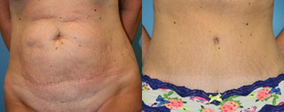 Case 2439 - 50 Year Old Female