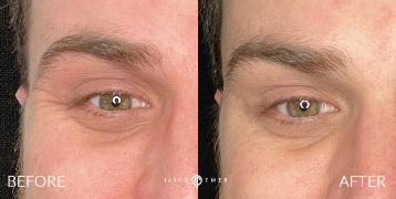 Case 5282 - Man treated with Botox