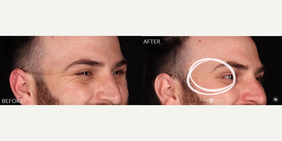 Case 6619 - Man treated with Botox