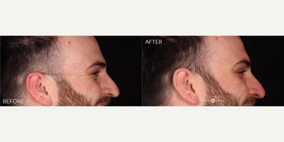 Case 6620 - Man treated with Botox