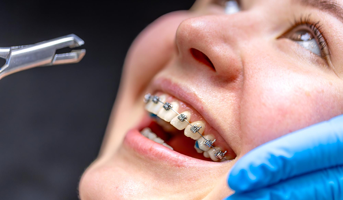 Orthodontics