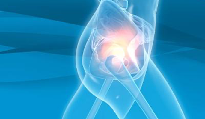 Hip Arthroscopy
