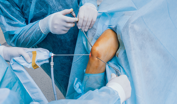 Knee Arthroscopic Washout Procedure
