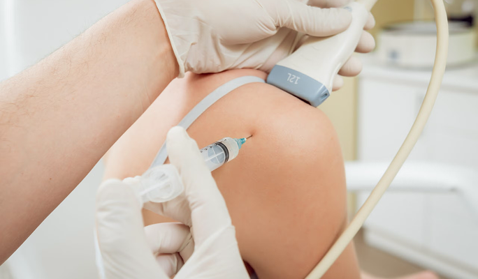 Ultrasound Guided Injection