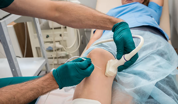 Radiofrequency Ablation