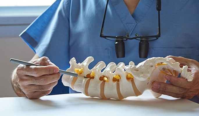 Lumbar Posterior Fusion (PF)