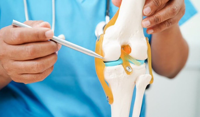 Stem Cell Therapy for Osteoarthritis