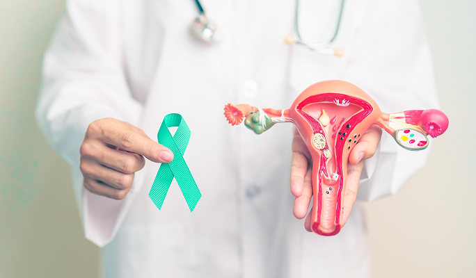 Ovarian Cancer