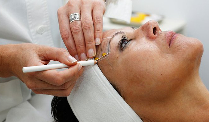 Ultherapy