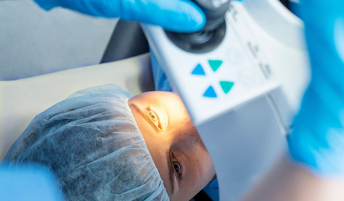 LASIK Monovision