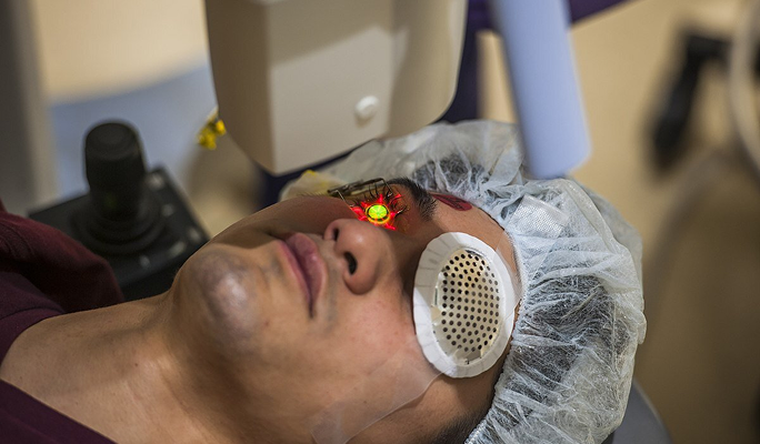 Macular Degeneration