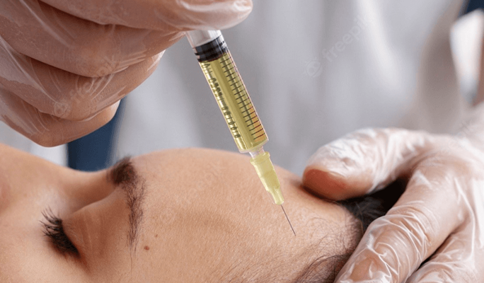 PRP Injection
