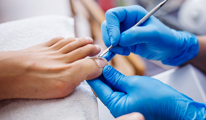 Laser Foot Surgery