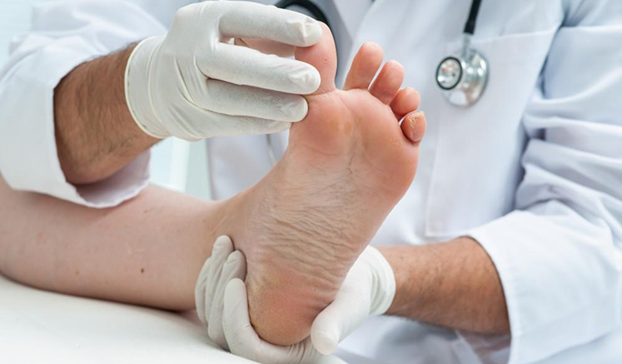 Ingrown Toenails