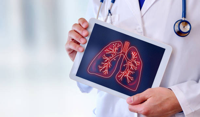 Lung Transplant