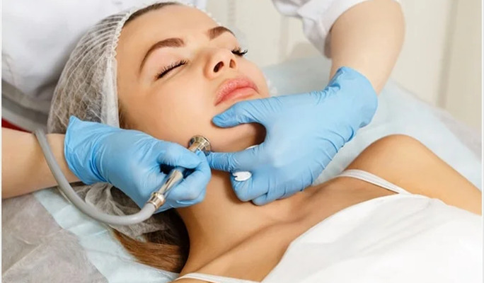 Dermabrasion