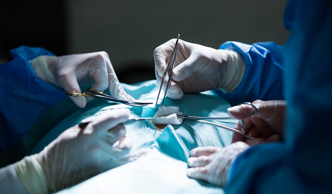 Peyronie's Disease Surgical Correction