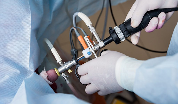 Reconstructive Urology Procedures