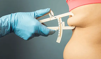 Biliopancreatic Diversion