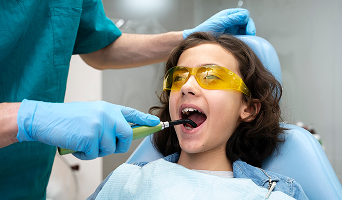 Dental Fillings (LED Composite per tooth)