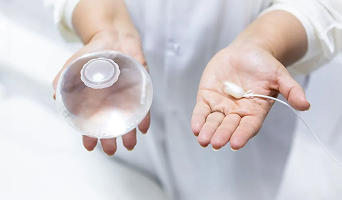 Gastric Balloon